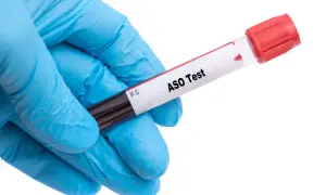 Rękawiczka w niebieskiej rękawiczce trzyma probówkę z napisem "ASO Test". Czy to wyjaśnia, dlaczego od marca 2026 r. ceny roboczogodziny w serwisach ASO skoczyły o 20 proc.?