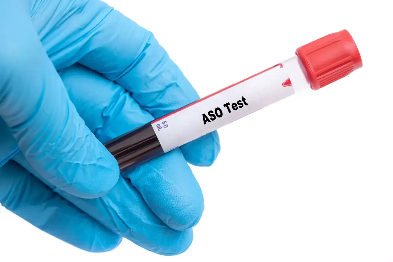 Rękawiczka w niebieskiej rękawiczce trzyma probówkę z napisem "ASO Test". Czy to wyjaśnia, dlaczego od marca 2026 r. ceny roboczogodziny w serwisach ASO skoczyły o 20 proc.?